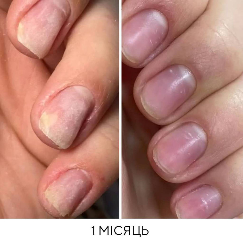 NAILSOFTHEDAY ONISTOP – регенеруюча олія проти оніхолізису, 15 ml